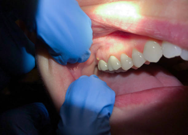 Best Weekend Emergency Dentist in Byng, OK